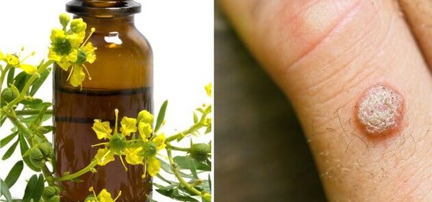 Behandlung von Warzen mit pharmazeutischem Schöllkraut